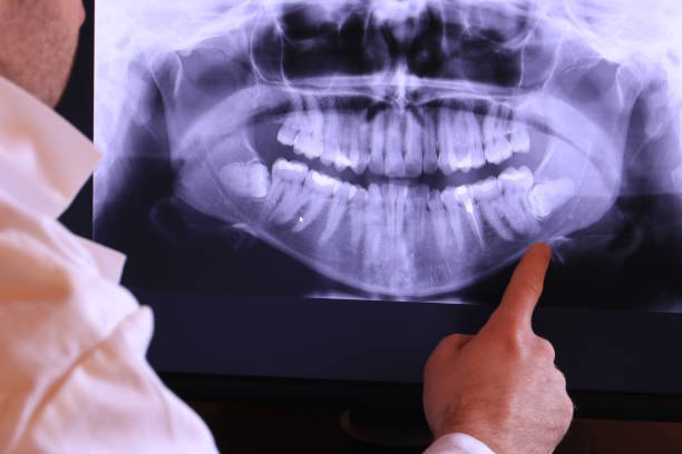 Dentist for Dental Trauma in VA